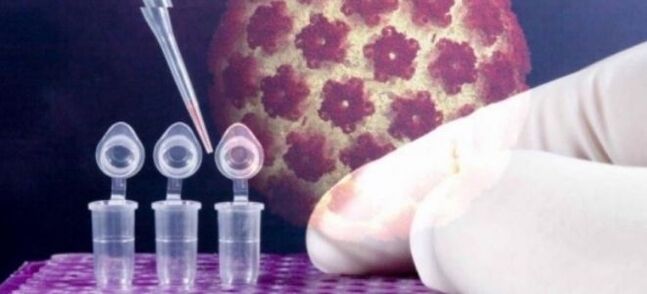 Digen testi yordamida HPV diagnostikasi